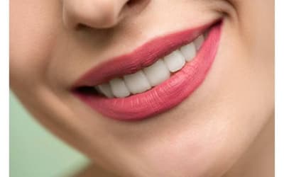 cosa fare con i denti scheggiati