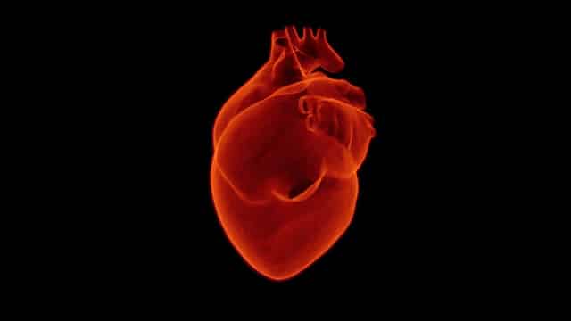 Infarto del miocardio