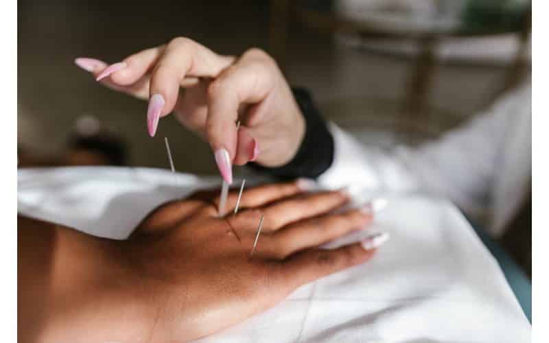 psoriasi e agopuntura